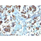 Immunohistochemistry - Anti-MUC3 Antibody [M3.1] - BSA and Azide free (A252604) - Antibodies.com