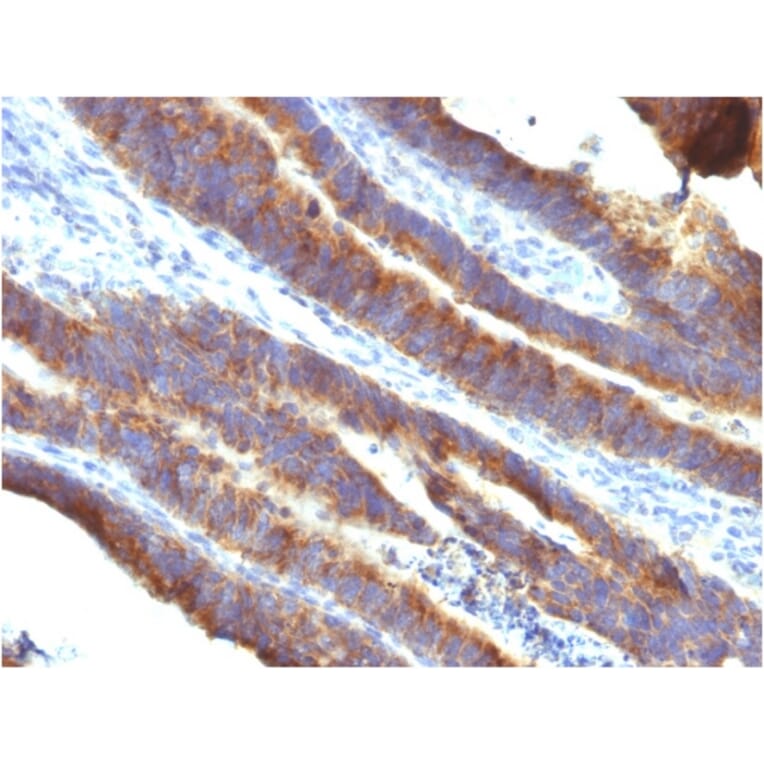 Immunohistochemistry - Anti-MUC3 Antibody [M3.1] - BSA and Azide free (A252603) - Antibodies.com