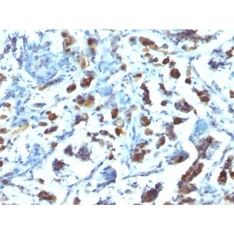 Immunohistochemistry - Anti-MUC3 Antibody [SPM200] - BSA and Azide free (A252604) - Antibodies.com