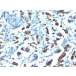 Immunohistochemistry - Anti-MUC3 Antibody [SPM200] - BSA and Azide free (A252604) - Antibodies.com