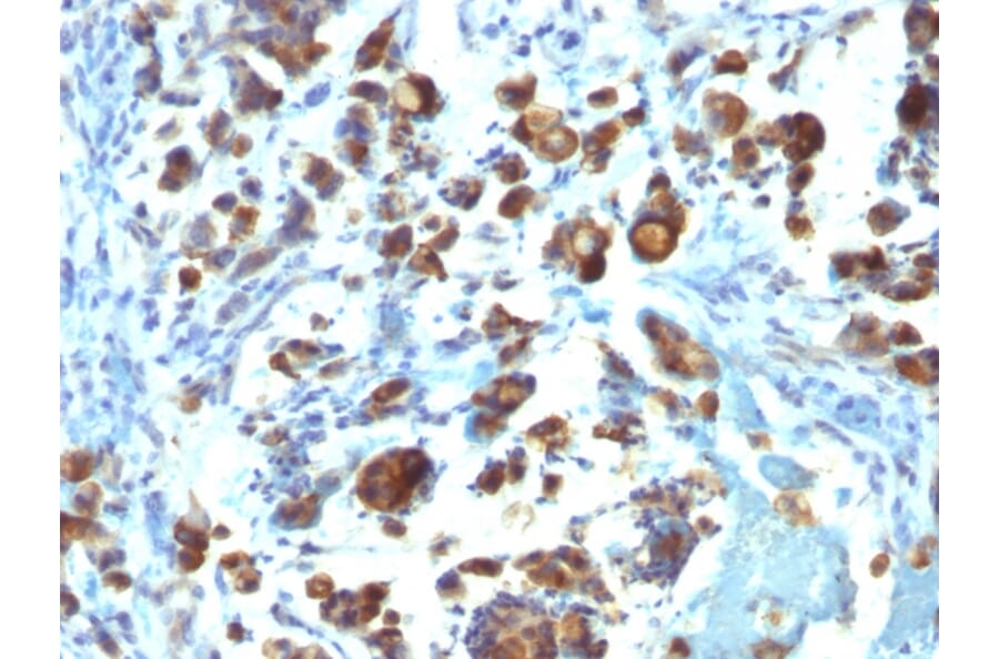 Immunohistochemistry - Anti-MUC3 Antibody [MUC3/1154] - BSA and Azide free (A252606) - Antibodies.com