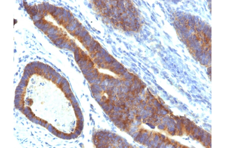 Immunohistochemistry - Anti-MUC3 Antibody [MUC3/1154] - BSA and Azide free (A252605) - Antibodies.com