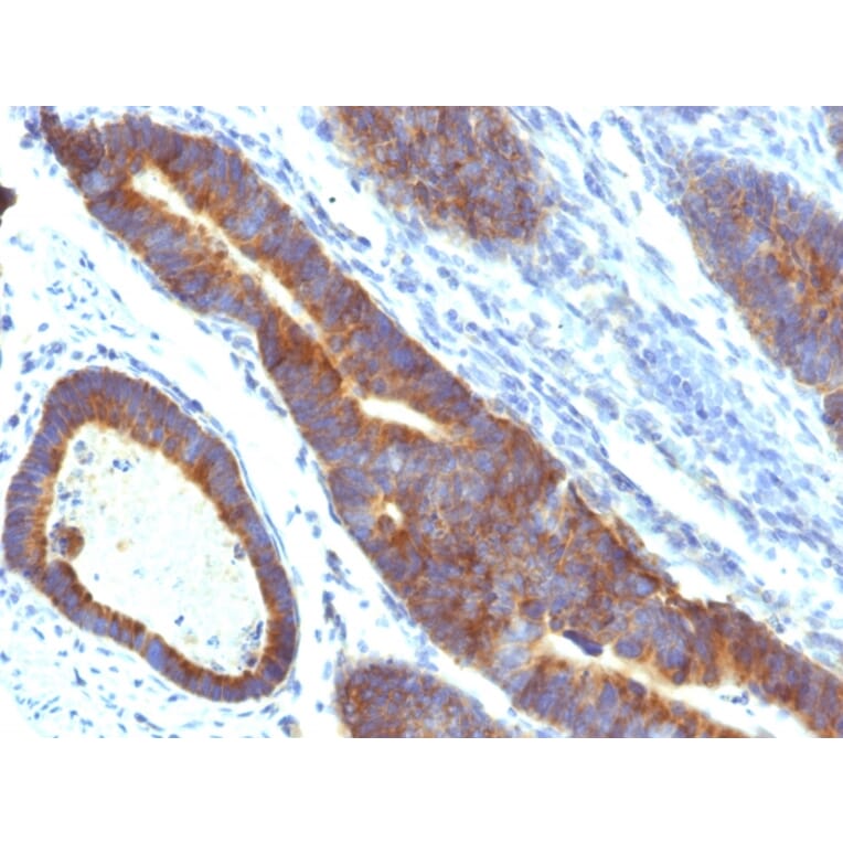 Immunohistochemistry - Anti-MUC3 Antibody [MUC3/1154] - BSA and Azide free (A252605) - Antibodies.com