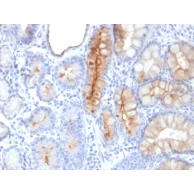 Immunohistochemistry - Anti-MUC4 Antibody [MUC4/3084] - BSA and Azide free (A252608) - Antibodies.com