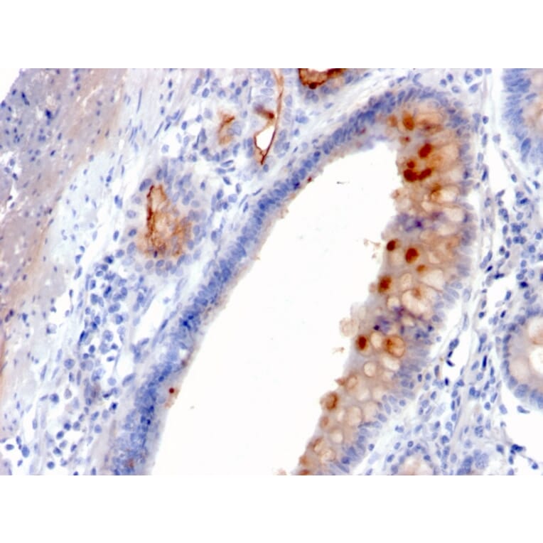 Immunohistochemistry - Anti-MUC4 Antibody [MUC4/3084] - BSA and Azide free (A252608) - Antibodies.com