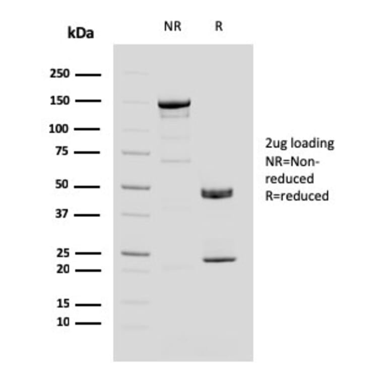 SDS-PAGE - Anti-MUC4 Antibody [MUC4/3084] - BSA and Azide free (A252608) - Antibodies.com