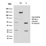 SDS-PAGE - Anti-MUC4 Antibody [MUC4/3084] - BSA and Azide free (A252608) - Antibodies.com