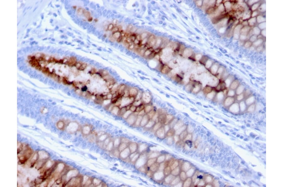 Immunohistochemistry - Anti-MUC4 Antibody [MUC4/3105] - BSA and Azide free (A252609) - Antibodies.com