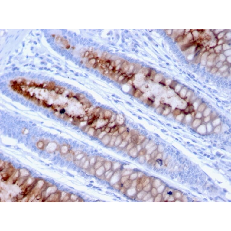 Immunohistochemistry - Anti-MUC4 Antibody [MUC4/3105] - BSA and Azide free (A252609) - Antibodies.com