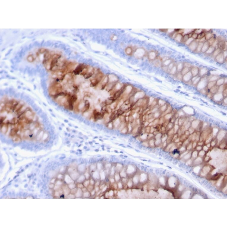 Immunohistochemistry - Anti-MUC4 Antibody [MUC4/3105] - BSA and Azide free (A252609) - Antibodies.com