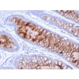 Immunohistochemistry - Anti-MUC4 Antibody [MUC4/3105] - BSA and Azide free (A252609) - Antibodies.com