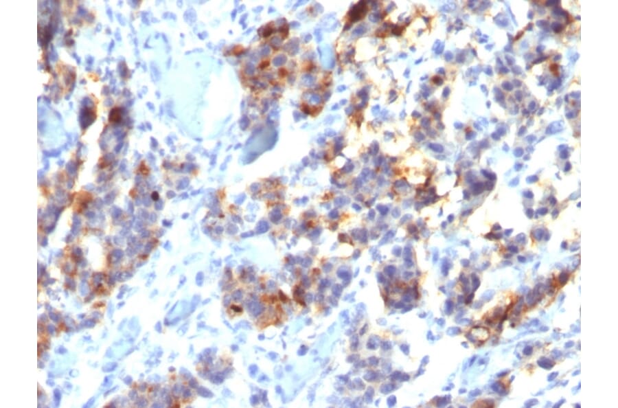 Immunohistochemistry - Anti-Mucin 5AC Antibody [45M1] - BSA and Azide free (A252610) - Antibodies.com