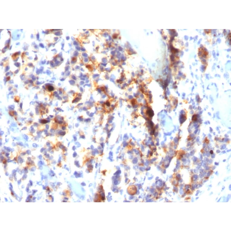Immunohistochemistry - Anti-Mucin 5AC Antibody [SPM297] - BSA and Azide free (A252611) - Antibodies.com