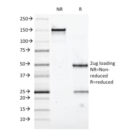 SDS-PAGE - Anti-Mucin 5AC Antibody [58M1] - BSA and Azide free (A252612) - Antibodies.com