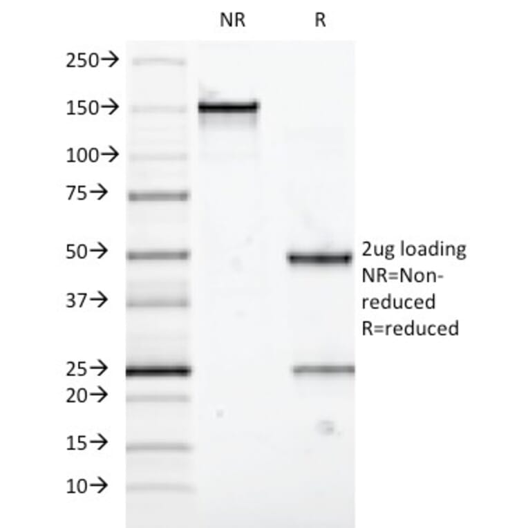SDS-PAGE - Anti-Mucin 5AC Antibody [58M1] - BSA and Azide free (A252612) - Antibodies.com