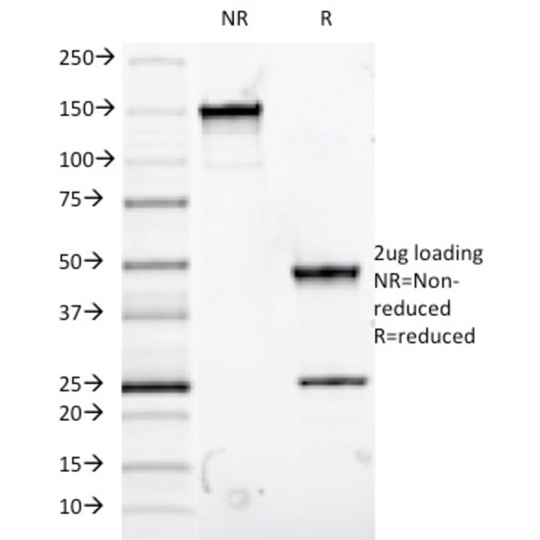 SDS-PAGE - Anti-Mucin 5AC Antibody [9-13M1] - BSA and Azide free (A252614) - Antibodies.com