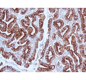 Immunohistochemistry - Anti-Mucin 5AC Antibody [CLH2] - BSA and Azide free (A252615) - Antibodies.com