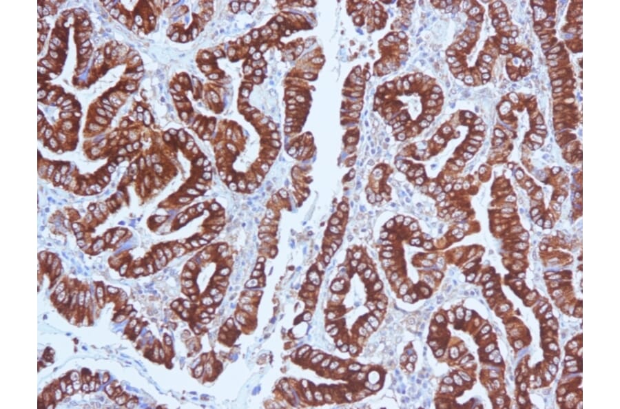 Immunohistochemistry - Anti-Mucin 5AC Antibody [CLH2] - BSA and Azide free (A252615) - Antibodies.com