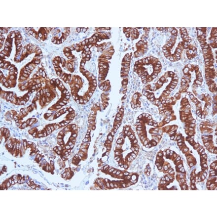 Immunohistochemistry - Anti-Mucin 5AC Antibody [CLH2] - BSA and Azide free (A252615) - Antibodies.com