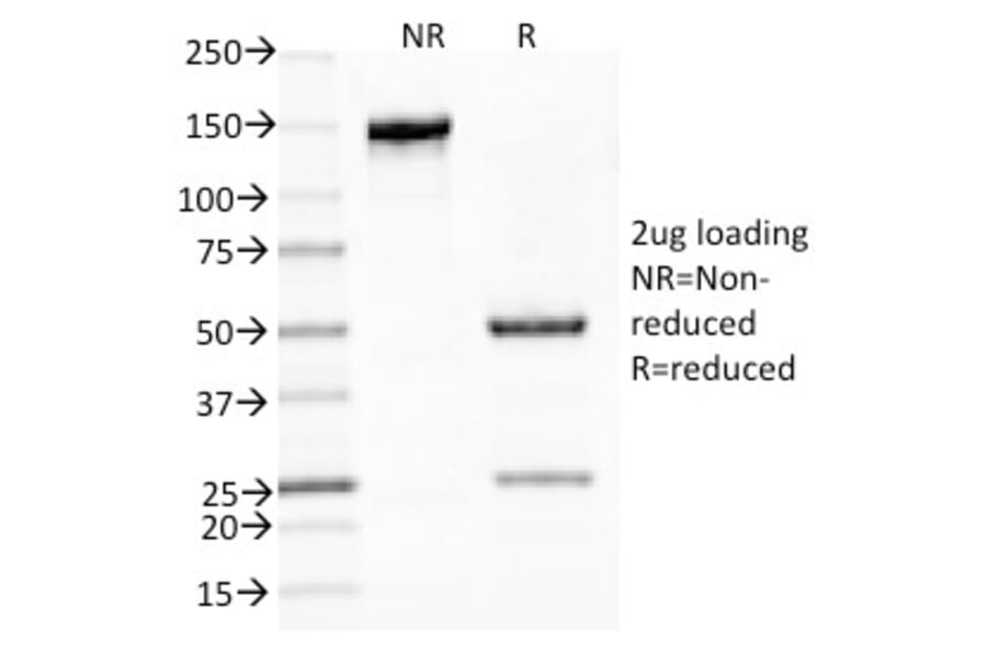 SDS-PAGE - Anti-Mucin 5AC Antibody [CLH2] - BSA and Azide free (A252616) - Antibodies.com