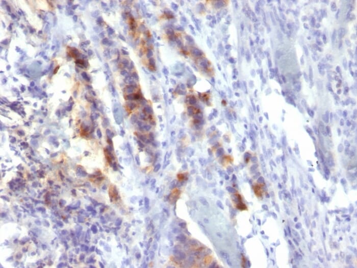 Anti-Mucin 5AC Antibody [SPM488] (A252617) | Antibodies.com