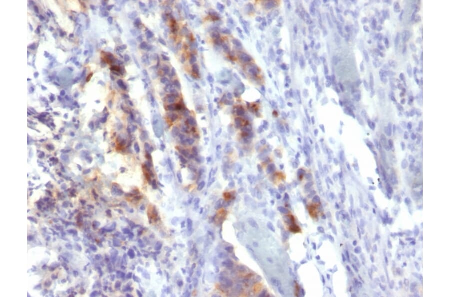 Immunohistochemistry - Anti-Mucin 5AC Antibody [SPM488] - BSA and Azide free (A252616) - Antibodies.com