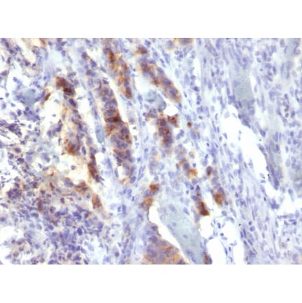 Immunohistochemistry - Anti-Mucin 5AC Antibody [SPM488] - BSA and Azide free (A252616) - Antibodies.com