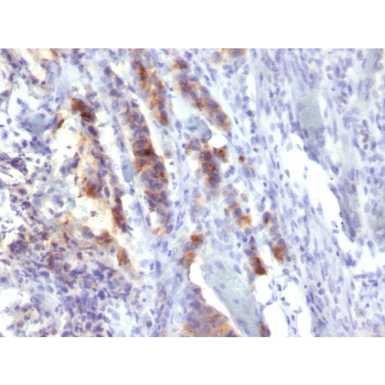 Immunohistochemistry - Anti-Mucin 5AC Antibody [SPM488] - BSA and Azide free (A252616) - Antibodies.com