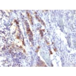 Immunohistochemistry - Anti-Mucin 5AC Antibody [SPM488] - BSA and Azide free (A252616) - Antibodies.com