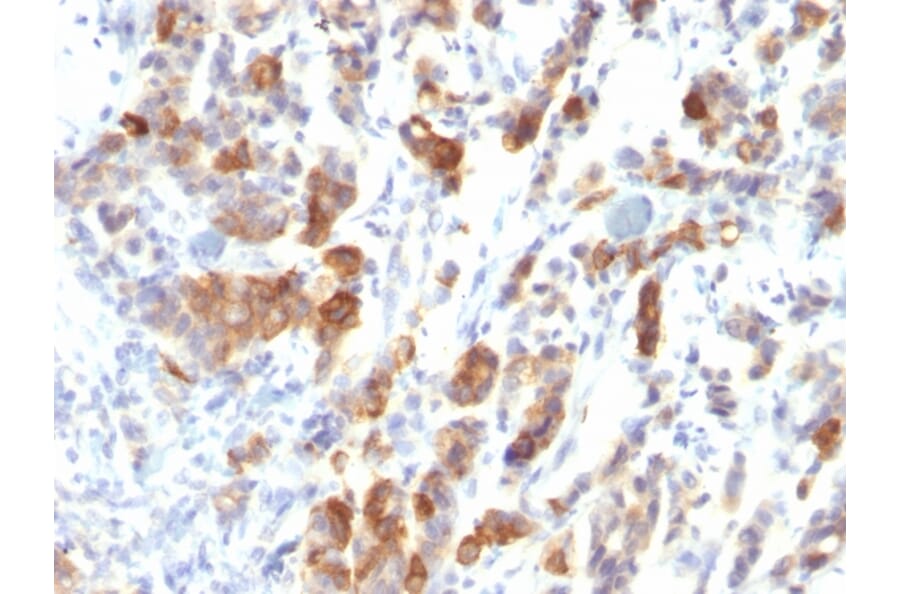 Immunohistochemistry - Anti-Mucin 5AC Antibody [MUC5AC/917] - BSA and Azide free (A252617) - Antibodies.com
