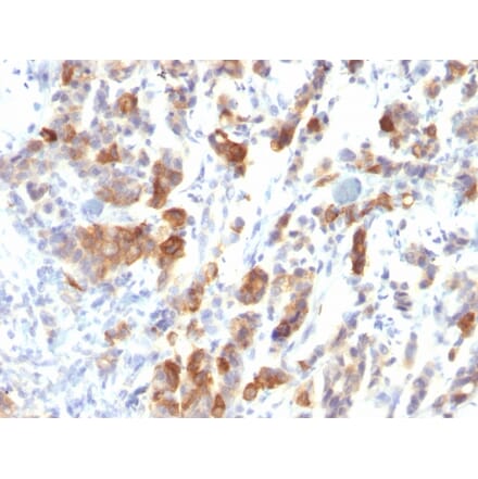 Immunohistochemistry - Anti-Mucin 5AC Antibody [MUC5AC/917] - BSA and Azide free (A252617) - Antibodies.com