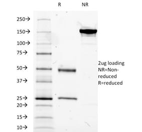 SDS-PAGE - Anti-Mucin 5AC Antibody [2-11M1] - BSA and Azide free (A252618) - Antibodies.com