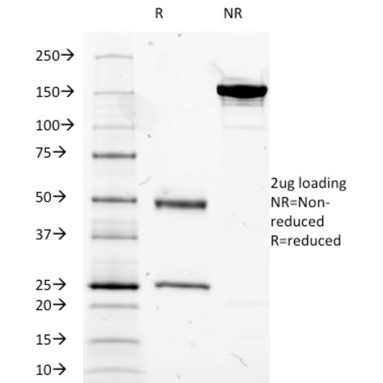 SDS-PAGE - Anti-Mucin 5AC Antibody [2-11M1] - BSA and Azide free (A252618) - Antibodies.com