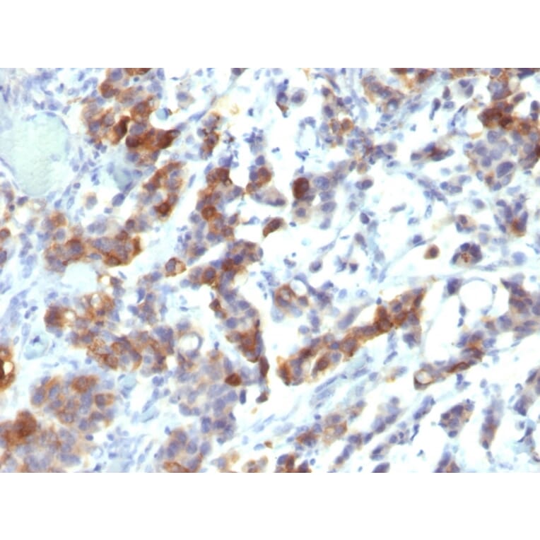 Immunohistochemistry - Anti-Mucin 5AC Antibody [MUC5AC/917 + 45M1] - BSA and Azide free (A252619) - Antibodies.com