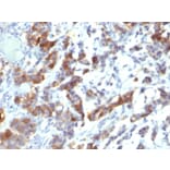 Immunohistochemistry - Anti-Mucin 5AC Antibody [MUC5AC/917 + 45M1] - BSA and Azide free (A252619) - Antibodies.com