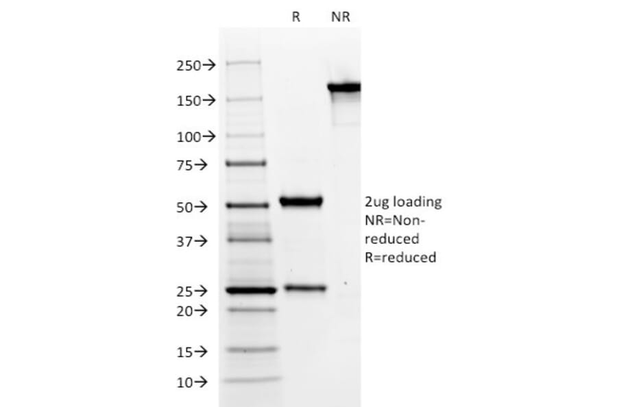 SDS-PAGE - Anti-MUC6 Antibody [CLH5] - BSA and Azide free (A252622) - Antibodies.com