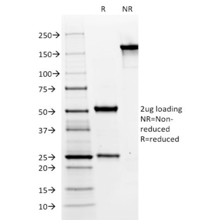 SDS-PAGE - Anti-MUC6 Antibody [CLH5] - BSA and Azide free (A252622) - Antibodies.com