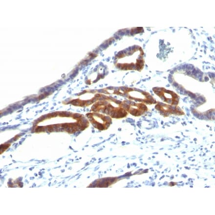 Immunohistochemistry - Anti-MUC6 Antibody [SPM598] - BSA and Azide free (A252622) - Antibodies.com