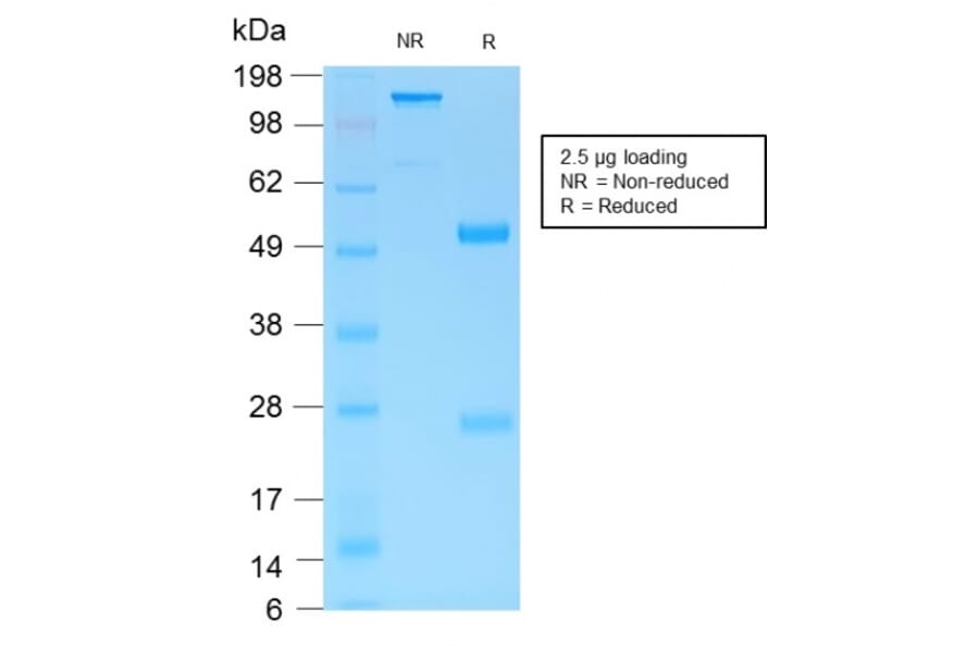 SDS-PAGE - Anti-MUC6 Antibody [MUC6/1553R] - BSA and Azide free (A252625) - Antibodies.com