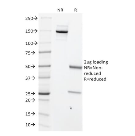 SDS-PAGE - Anti-c-Myc Antibody [MYC699] - BSA and Azide free (A252627) - Antibodies.com