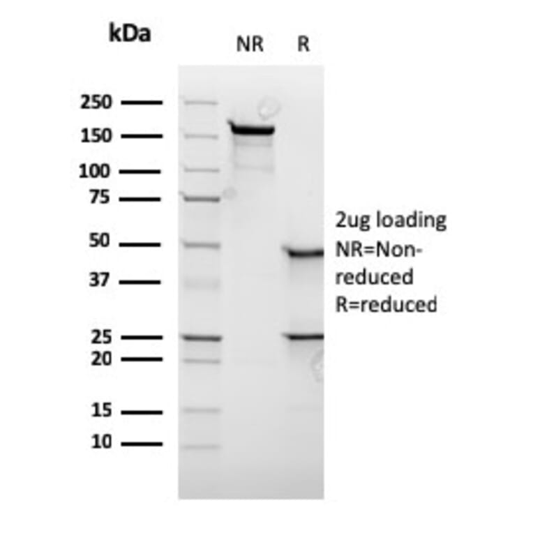 SDS-PAGE - Anti-c-Myc Antibody [rMYC909] - BSA and Azide free (A252636) - Antibodies.com