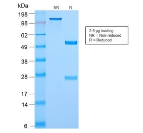 SDS-PAGE - Anti-c-Myc Antibody [MYC2895R] - BSA and Azide free (A252637) - Antibodies.com