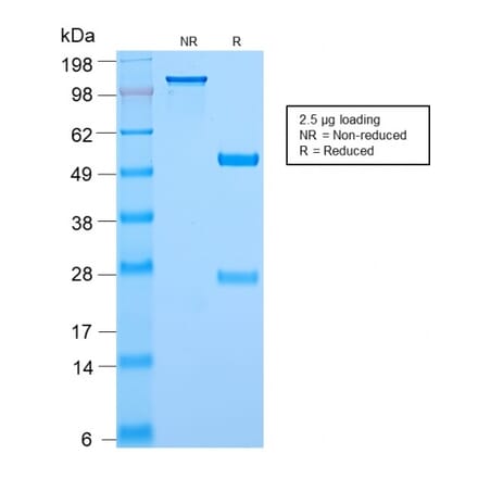 SDS-PAGE - Anti-c-Myc Antibody [MYC2895R] - BSA and Azide free (A252637) - Antibodies.com