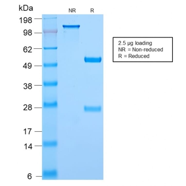 SDS-PAGE - Anti-c-Myc Antibody [MYC2895R] - BSA and Azide free (A252637) - Antibodies.com