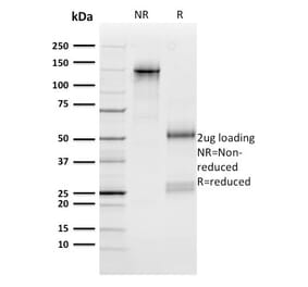 SDS-PAGE - Anti-n-Myc Antibody [NMYC-1] - BSA and Azide free (A252637) - Antibodies.com