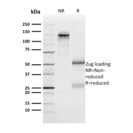 SDS-PAGE - Anti-n-Myc Antibody [NMYC-1] - BSA and Azide free (A252637) - Antibodies.com