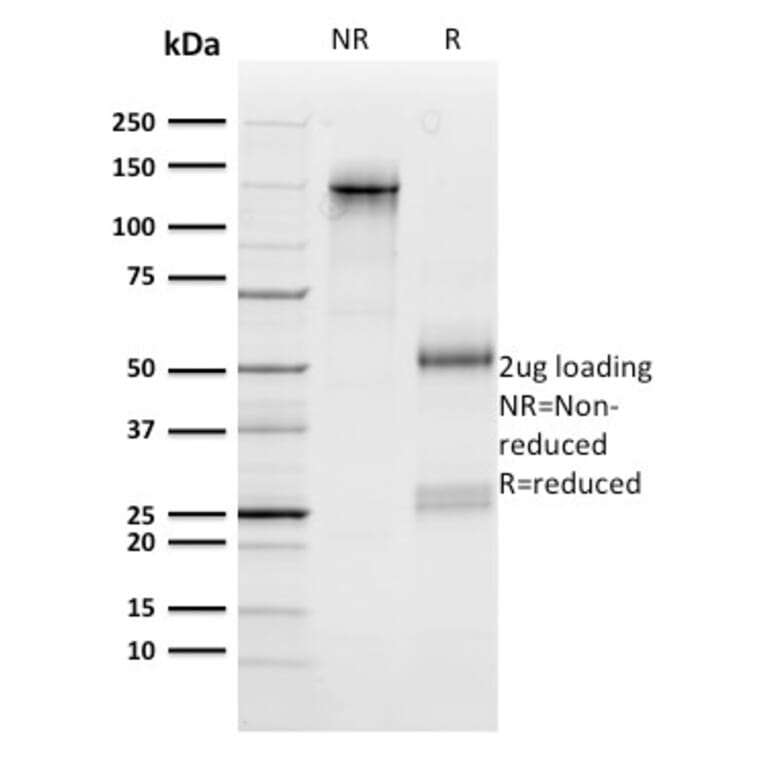 SDS-PAGE - Anti-n-Myc Antibody [NMYC-1] - BSA and Azide free (A252637) - Antibodies.com