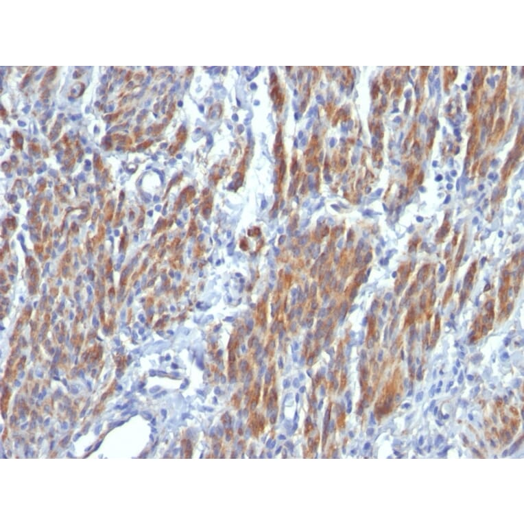 Immunohistochemistry - Anti-MYH11 Antibody [SMMS-1] - BSA and Azide free (A252639) - Antibodies.com