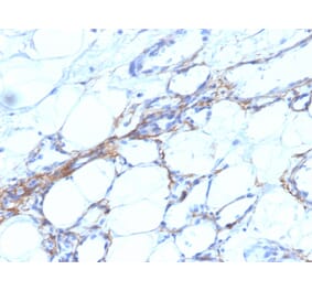 Immunohistochemistry - Anti-MYH11 Antibody [SPM201] - BSA and Azide free (A252639) - Antibodies.com