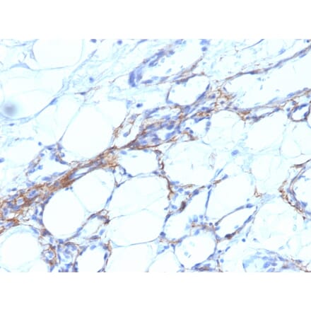Immunohistochemistry - Anti-MYH11 Antibody [SPM201] - BSA and Azide free (A252639) - Antibodies.com